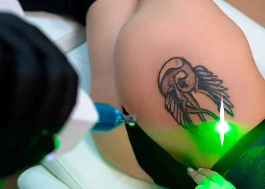Professional laser skin treatment in a clinical setting